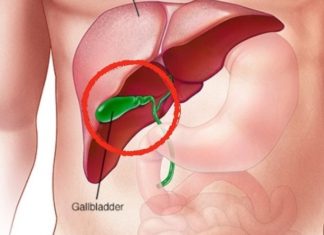 How Does the Body Change After Gallbladder Removal?