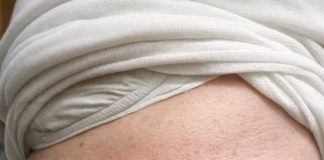 Mom has this blistering rash wrapping around her side. She says the burning pain is unbearable. ER wait is 8 hours! What can we do?