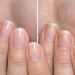 Rub this 1 solution on your nails and get rid of splitting, flaking, and rough textured ridges