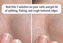 Rub this 1 solution on your nails and get rid of splitting, flaking, and rough textured ridges