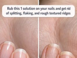 Rub this 1 solution on your nails and get rid of splitting, flaking, and rough textured ridges