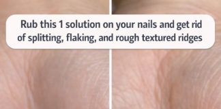 Rub this 1 solution on your nails and get rid of splitting, flaking, and rough textured ridges