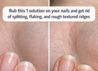Rub this 1 solution on your nails and get rid of splitting, flaking, and rough textured ridges