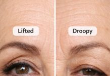 My Grandma taught me this trick to lift hooded eyes in just 2 mins with 0 effort. Here’s how it works