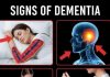10 Early Signs of Dementia You Should NEVER Ignore!….