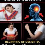 10 Early Signs of Dementia You Should NEVER Ignore!….