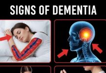 10 Early Signs of Dementia You Should NEVER Ignore!….