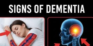 10 Early Signs of Dementia You Should NEVER Ignore!….