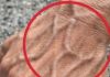 If Someone Has Visible Veins, Does It Mean Their Circulation Is Poor?