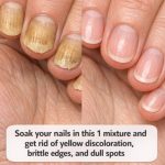 Soak your nails in this 1 mixture and get rid of yellow discoloration, brittle edges, and dull spots