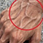 If Someone Has Visible Veins, Does It Mean Their Circulation Is Poor?