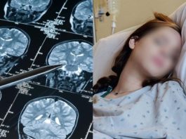 5 Alarming Stroke Warning Signs to Watch for in Young People