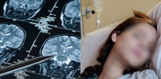 5 Alarming Stroke Warning Signs to Watch for in Young People