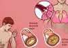 10 home remedies that help to reduce phlegm from your chest & throat