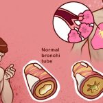 10 home remedies that help to reduce phlegm from your chest & throat