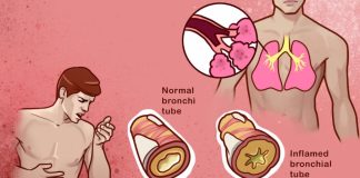 10 home remedies that help to reduce phlegm from your chest & throat