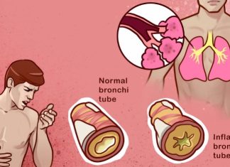 10 home remedies that help to reduce phlegm from your chest & throat
