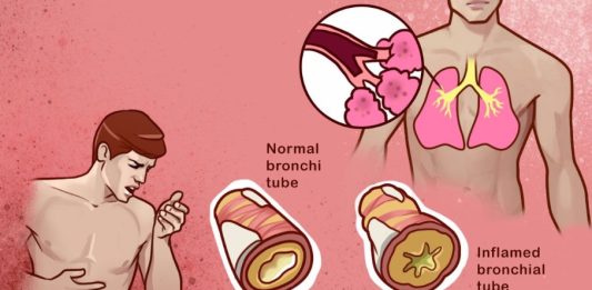 10 home remedies that help to reduce phlegm from your chest & throat
