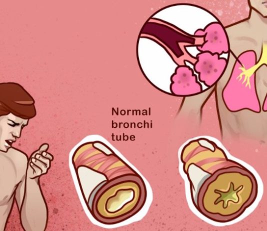 10 home remedies that help to reduce phlegm from your chest & throat
