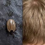 How to Stay Calm When You Discover Unwanted “Guests” in Your Child’s Hair