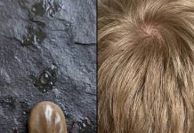 How to Stay Calm When You Discover Unwanted “Guests” in Your Child’s Hair