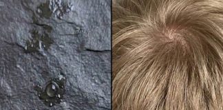 How to Stay Calm When You Discover Unwanted “Guests” in Your Child’s Hair