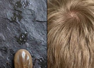 How to Stay Calm When You Discover Unwanted “Guests” in Your Child’s Hair