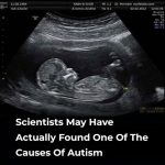 Scientists May Have Actually Found One Of The Causes Of Autism