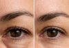 Place this 1 trick under your eyes and get rid of puffiness, swelling, and tired sagging skin
