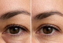 Place this 1 trick under your eyes and get rid of puffiness, swelling, and tired sagging skin