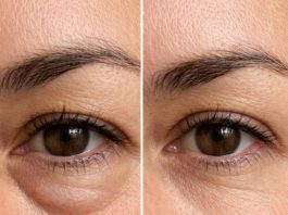 Place this 1 trick under your eyes and get rid of puffiness, swelling, and tired sagging skin