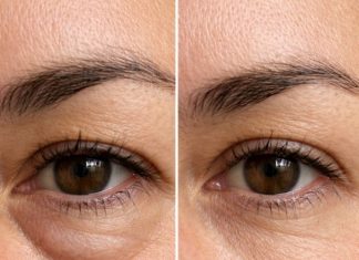 Place this 1 trick under your eyes and get rid of puffiness, swelling, and tired sagging skin