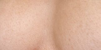 Apply this 1 mixture on your under chest area and get rid of red sweat rashes, painful chafing, and irritation.
