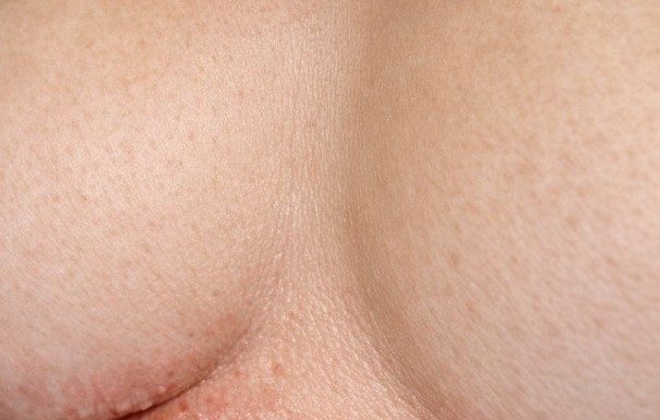Apply this 1 mixture on your under chest area and get rid of red sweat rashes, painful chafing, and irritation.