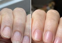 Soak your nails in this 1 mixture and get rid of brittle ridges, vertical lines, and flaky layers