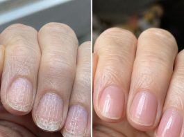 Soak your nails in this 1 mixture and get rid of brittle ridges, vertical lines, and flaky layers