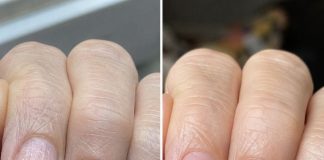 Soak your nails in this 1 mixture and get rid of brittle ridges, vertical lines, and flaky layers