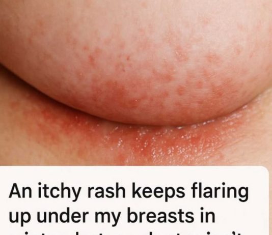 An itchy rash keeps flaring up under my breasts in winter, but my doctor isn’t available right now. What can I do today?