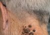 My grandpa has these dark waxy bumps on his neck that itch. What are they?