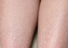 My lower legs keep developing fine white scales, and lotion barely helps. What can I do now?