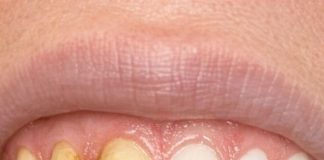 Swish this 1 mixture in your mouth and get rid of coffee stains, tea discoloration, and dull enamel
