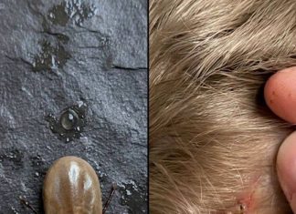 How to stay calm when you find unwanted “guests” in your child’s hair.