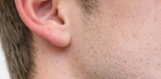 Found these red bites in a straight line on my brother’s neck this morning. He’s freaking out. Does anyone know what bit him so we can treat it?