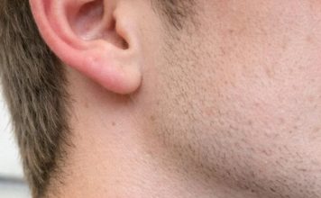 Found these red bites in a straight line on my brother’s neck this morning. He’s freaking out. Does anyone know what bit him so we can treat it?