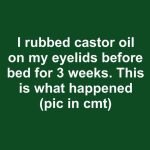 I rubbed castor oil on my eyelids before bed for 3 weeks. This is what happened