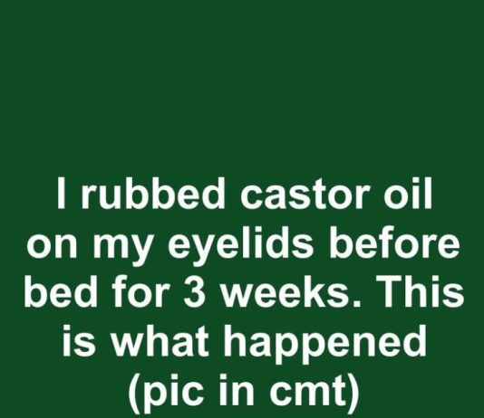 I rubbed castor oil on my eyelids before bed for 3 weeks. This is what happened