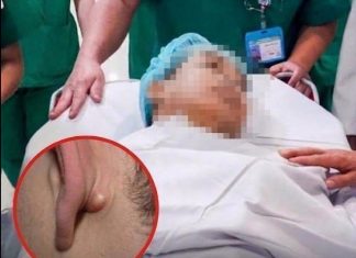 Young Man Dies After Ignoring Two Nighttime Symptoms: A Reminder About Early Cancer Warning Signs