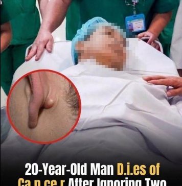 Young Man Dies After Ignoring Two Nighttime Symptoms: A Reminder About Early Cancer Warning Signs