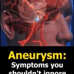 12 Early Warning Signs of an Aneurysm You Shouldn’t Ignore