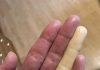 These are the consequences of sleeping with the…